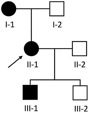 Phenotypic variability within the desminopathies: A case series of three patients